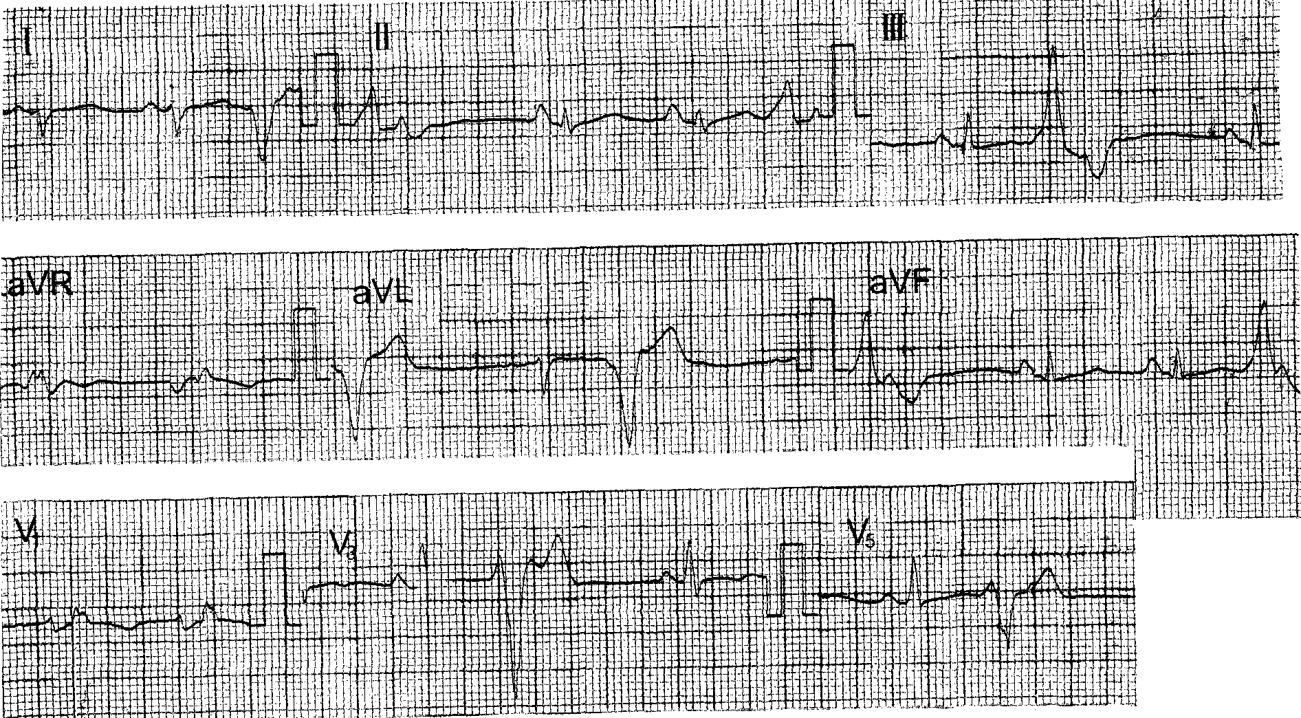超声心动图实用指南正常和异常心脏第三3版刘琳主译产前胎儿心脏筛查 - 动态图库网