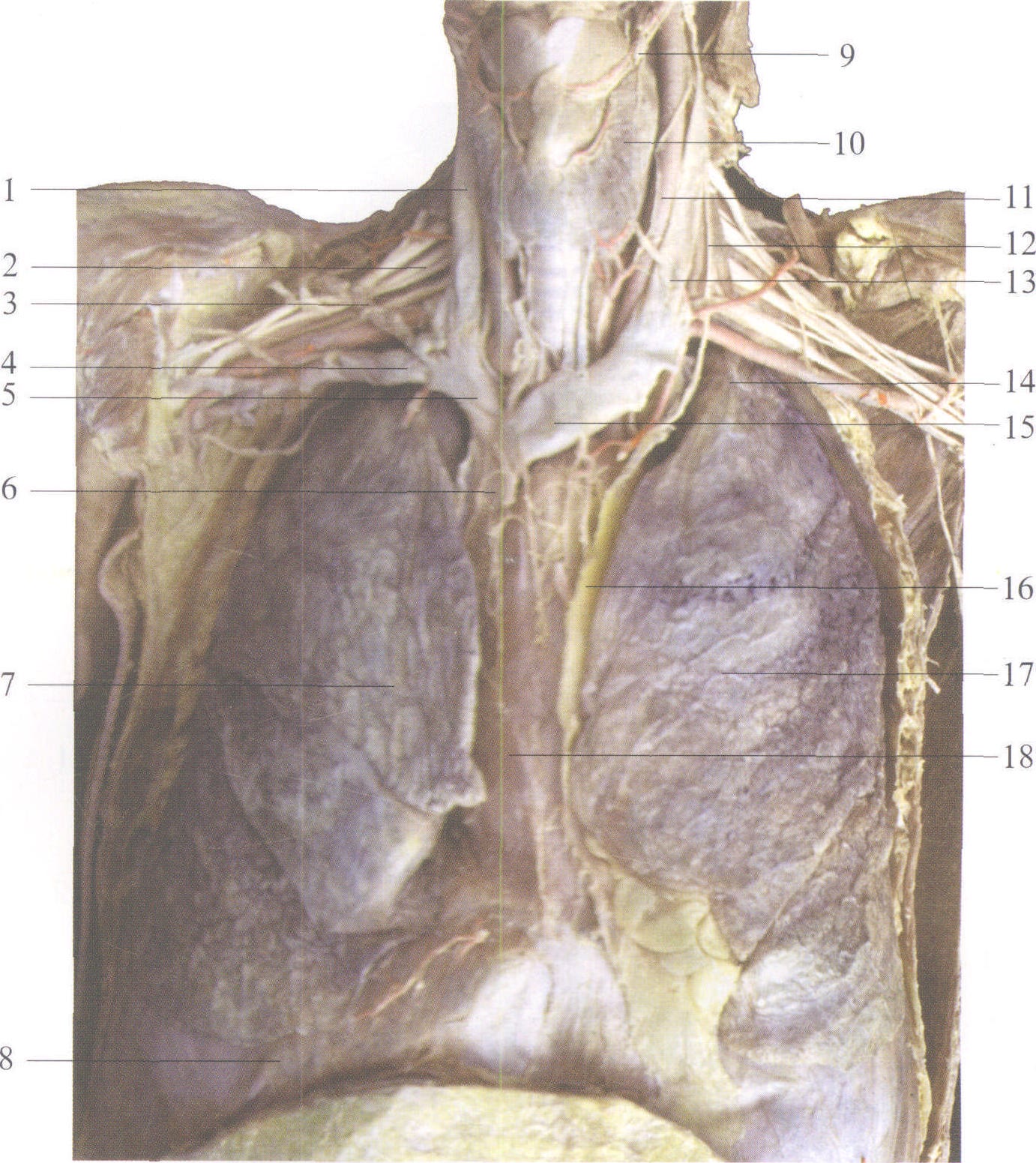 图3-199 手部血管铸型(背面观)(1)-骨科临床解剖学-医学