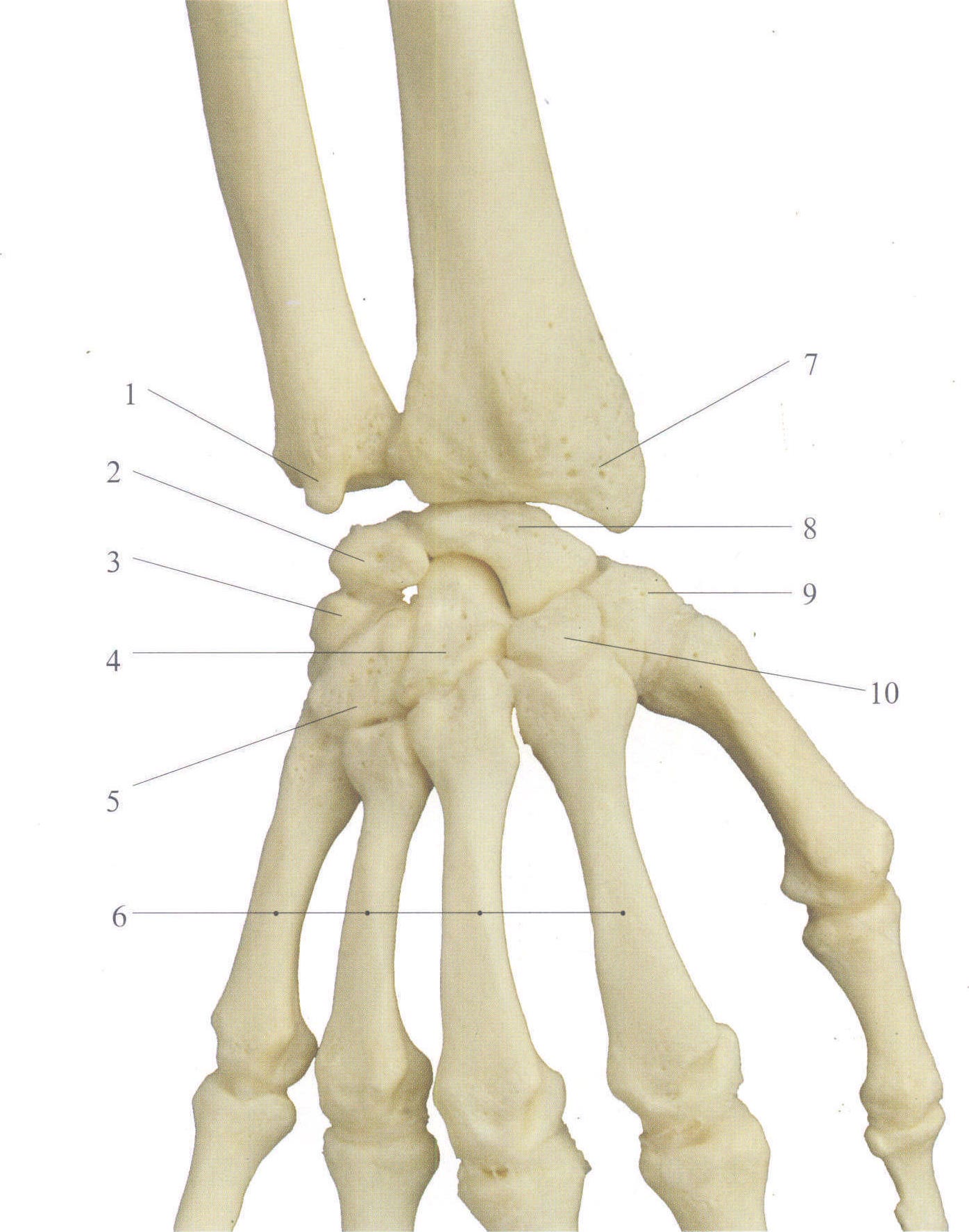 图3-162 手骨(背面观)-外科学-医学