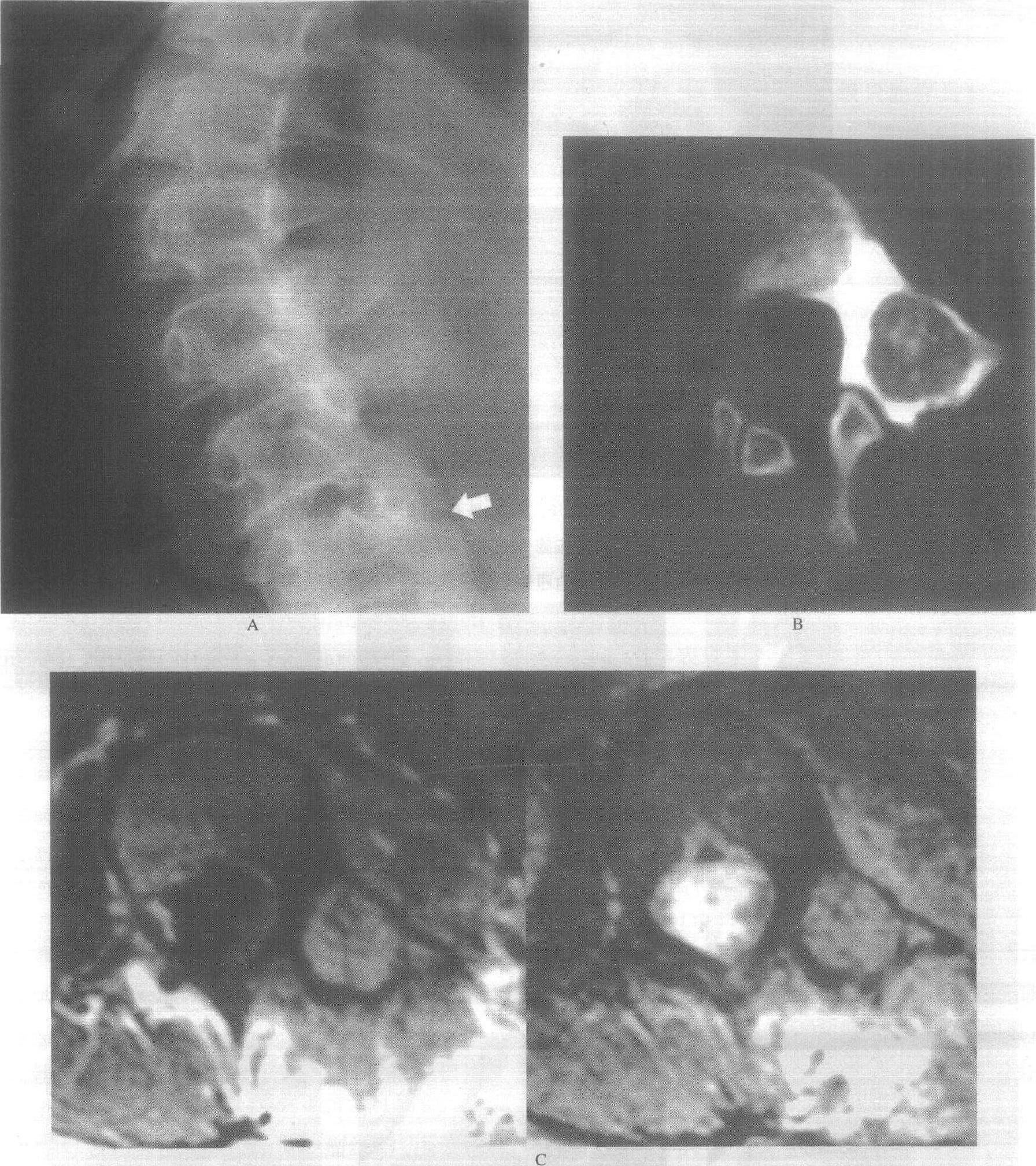 磁共振（MRI）四肢长骨、腿部扫描技术_序列