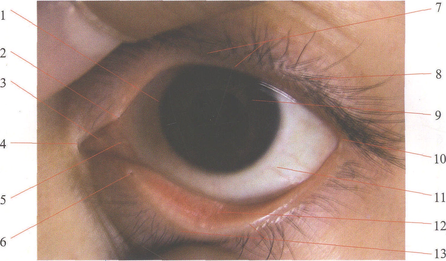 图18～34 眼的发生(二)-基础医学-医学