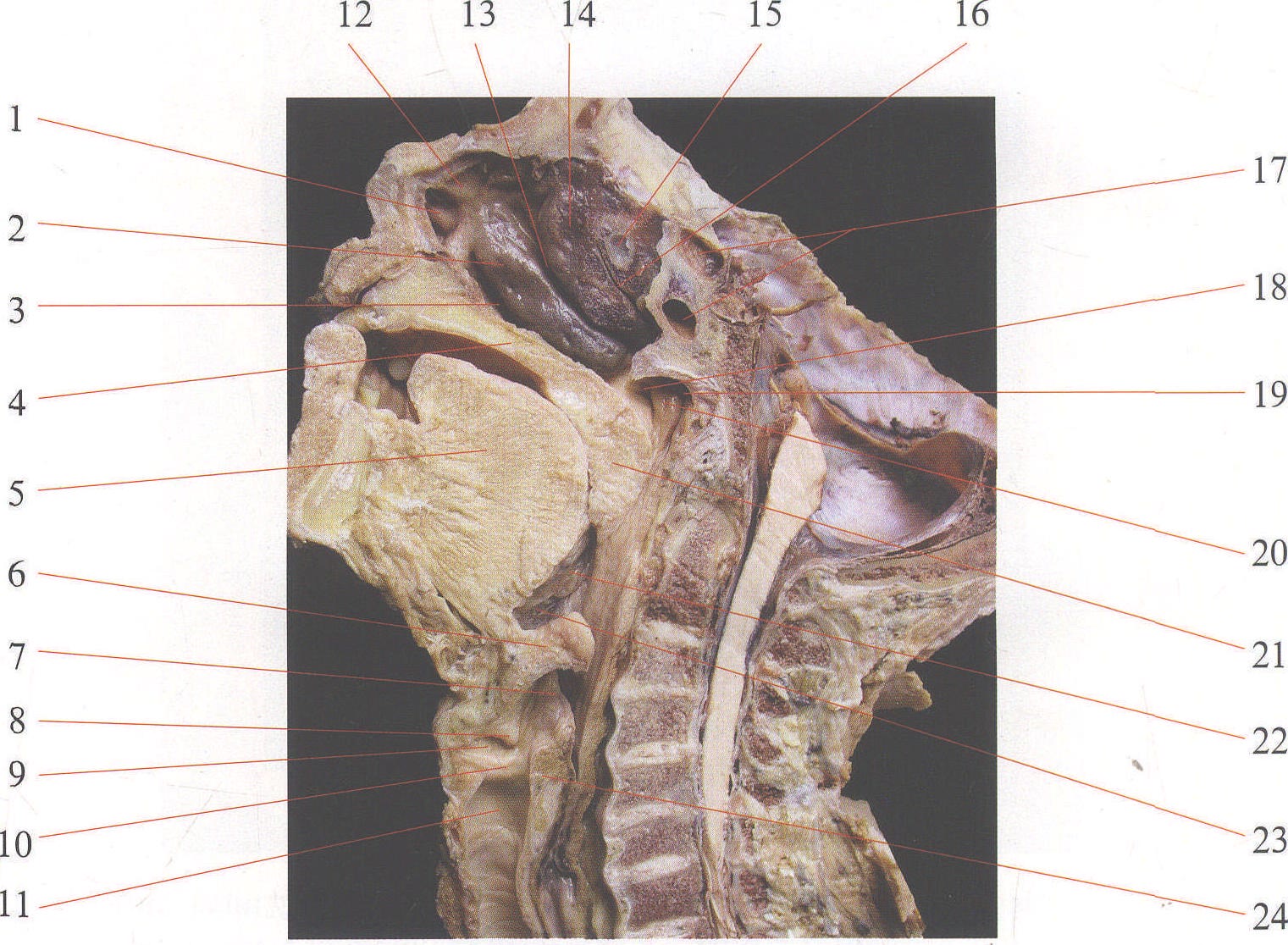 图1-83 喉韧带和喉肌-基础医学-医学