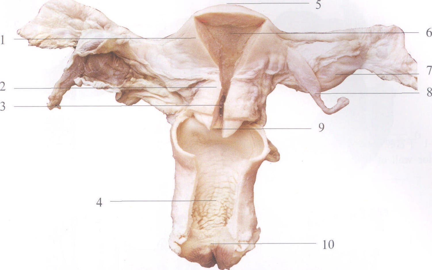 图2-168 阴道毗邻(平子宫颈口水平切)-妇产科临床解剖学-医学
