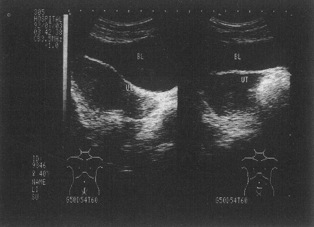 女性医学 生殖器 卵巢 宫口 宫颈 输卵管 子宫 妇科 阴道 子宫颈-cg模型免费下载-CG99