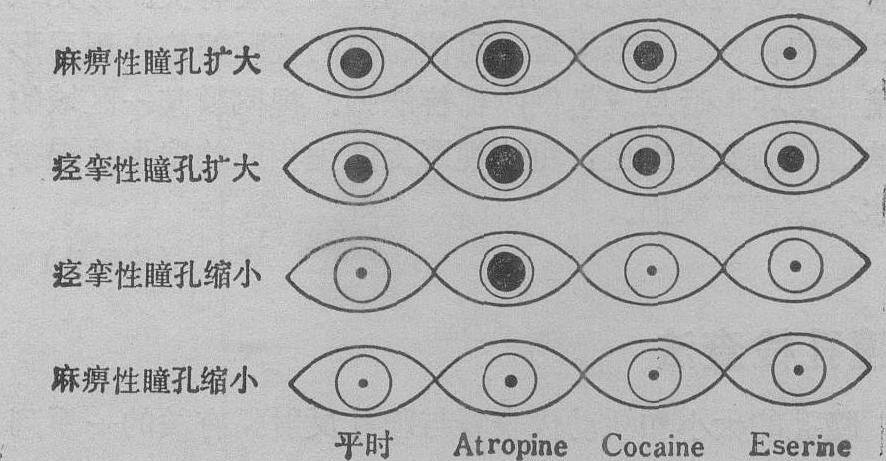瞳孔检查法
