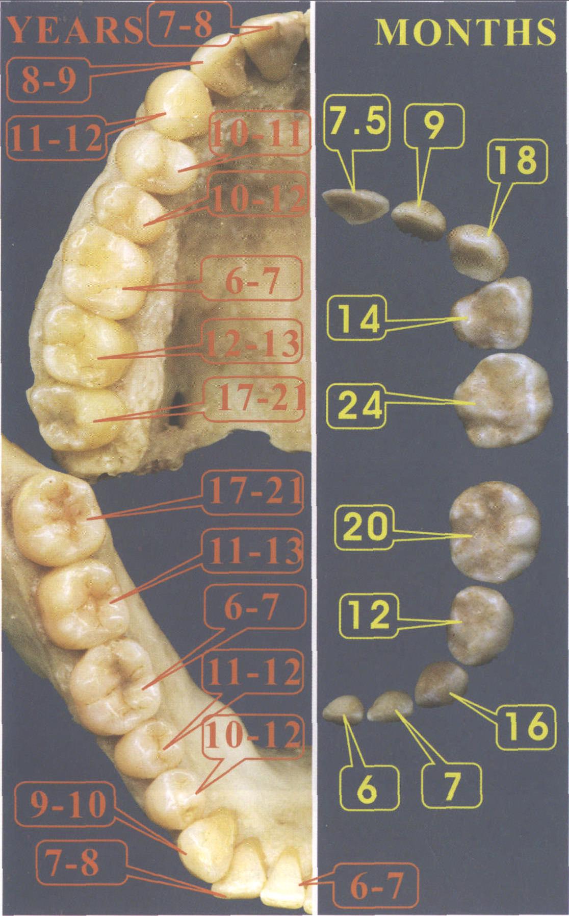 儿童乳牙恒牙交替模型M7011展示乳恒牙的萌出及发育情况-阿里巴巴