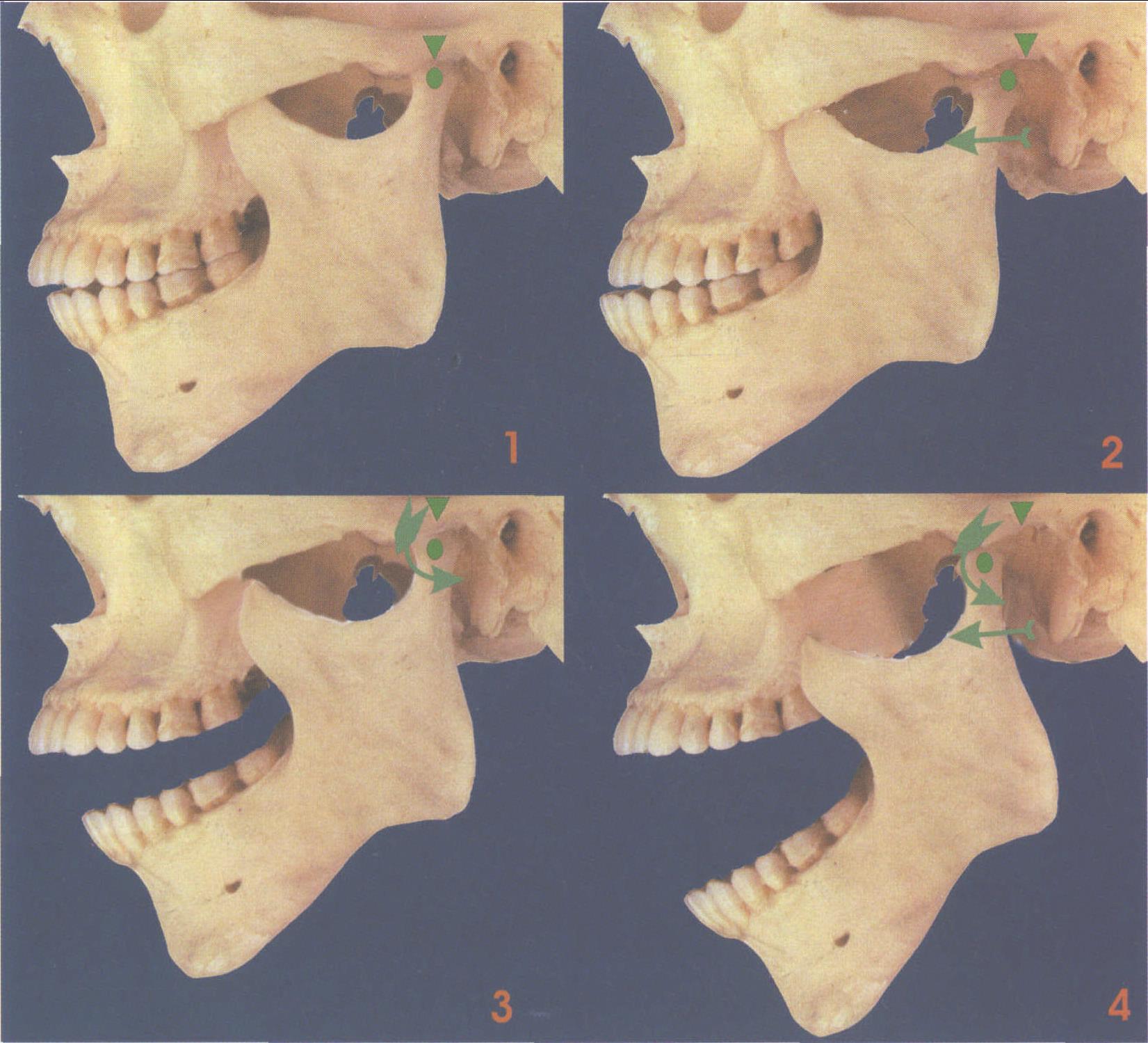 图1-53 下颌骨-临床解剖学-医学
