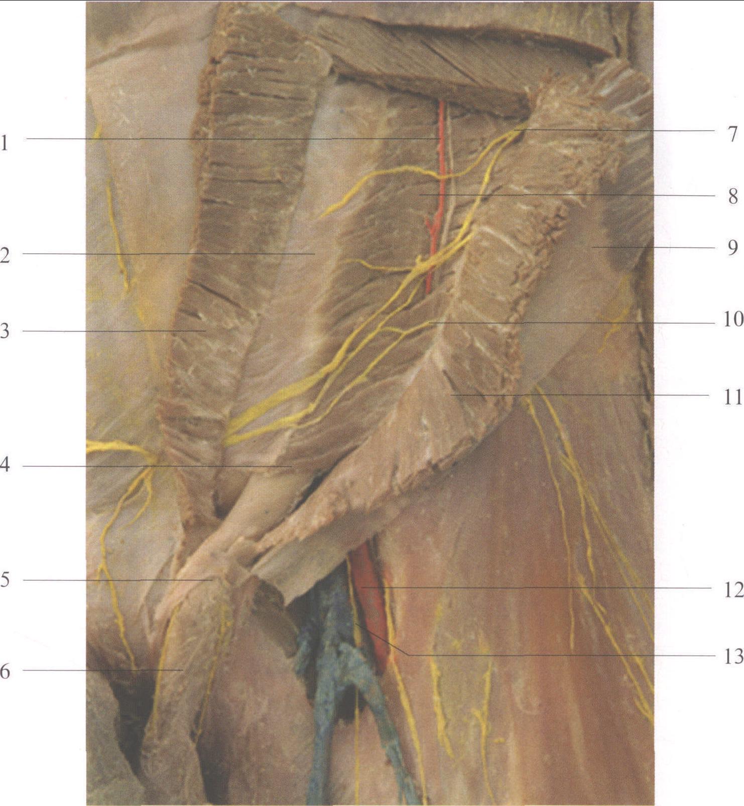 图3-3 腹前外侧壁 右前面观 显示腹横肌-基础医学-医学