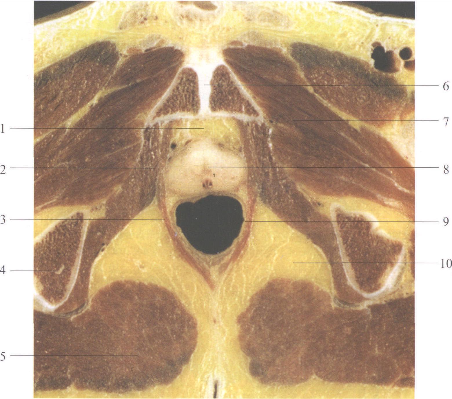 图4-12 前列腺和精囊的结构-泌尿外科临床解剖学-医学