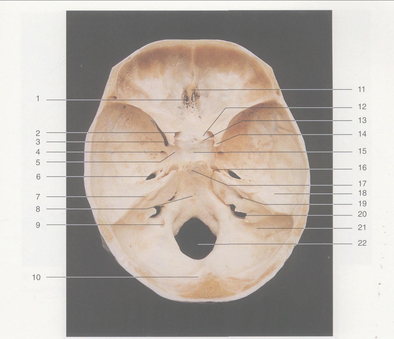 图50 颅骨前面观-人体解剖学实验-医学