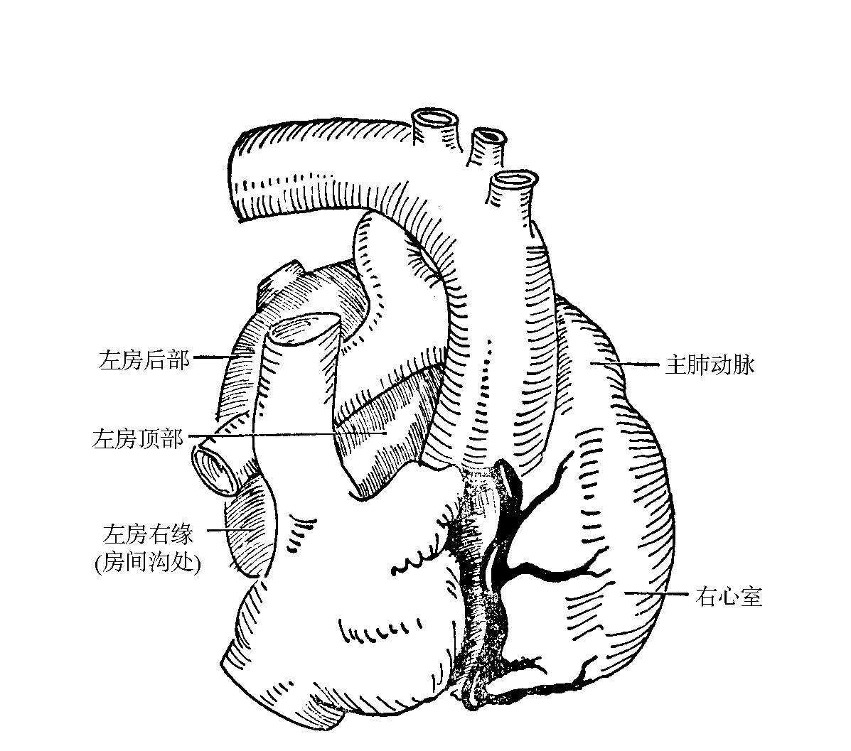 图72左心房顶部