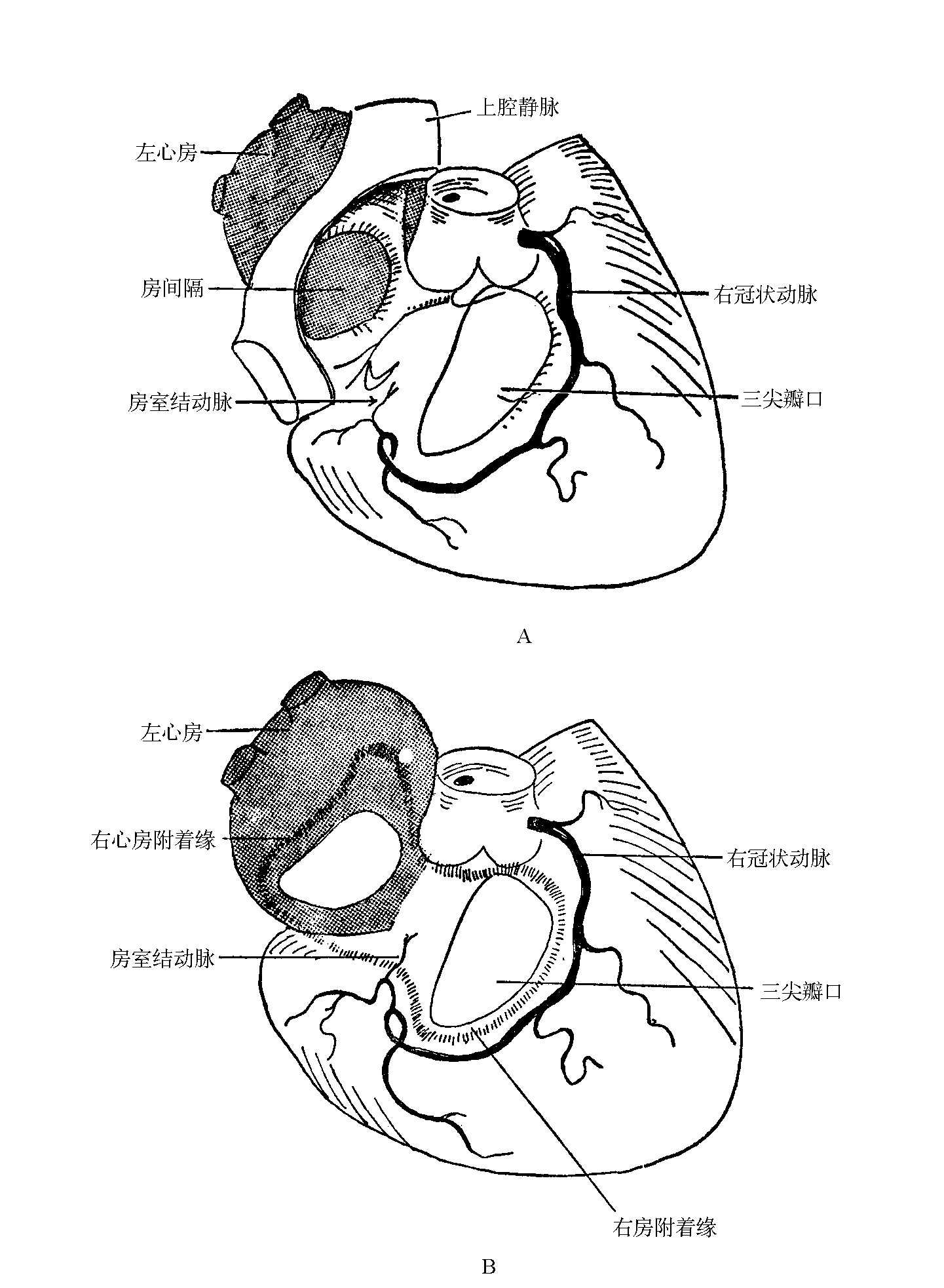 图15-22 经左、右心室的矢状断面-外科学-医学