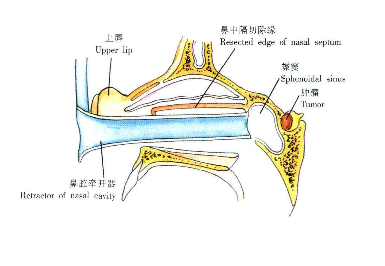 图1-1-25 咽隐窝层面-神经外科临床解剖学-医学