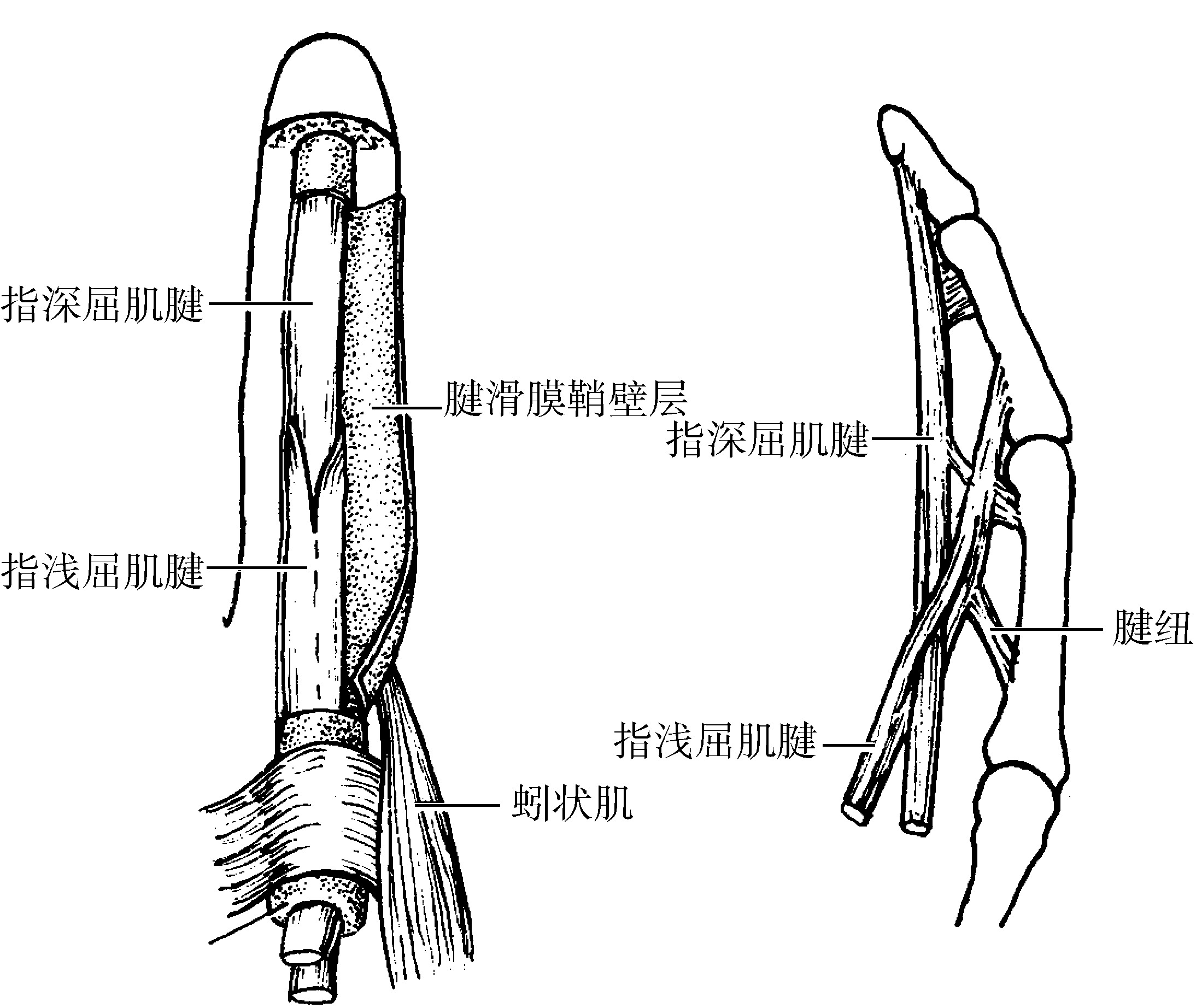图7-29 手背侧的肌肉、腱鞘和血管-基础医学-医学