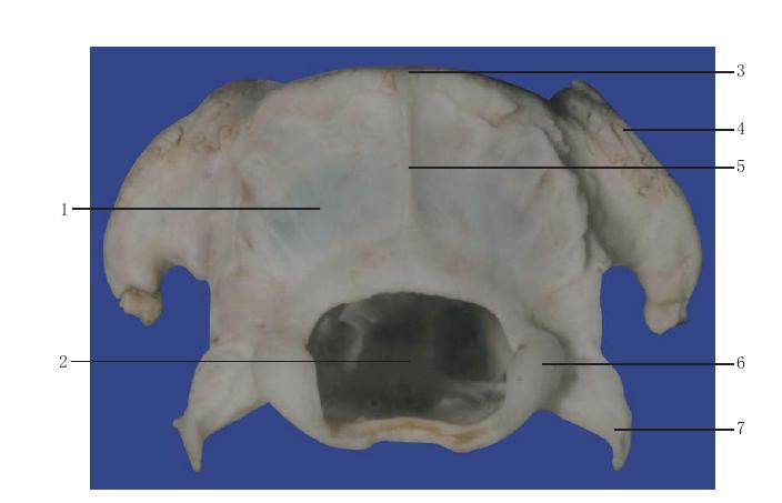 图1-6 颅骨后面观