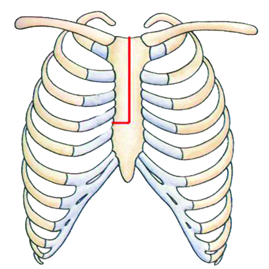 图5-2-13 颞下颌关节矢状MRIT1像-口腔解剖-医学