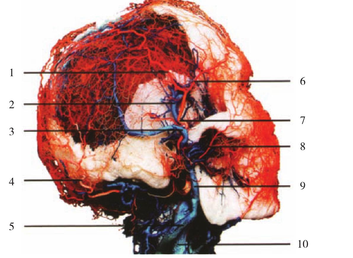 图1-17  头面部动、静脉铸型(侧面观4)