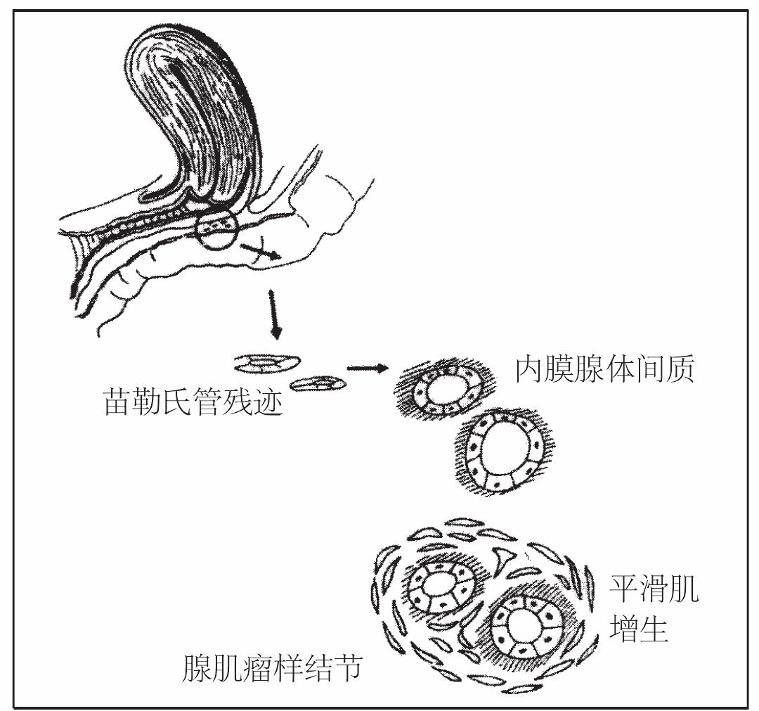 七、高分辨率MRI增强在直肠癌T分期中的临床应用|上海大学附属上海全景云医学影像诊断中心|全景医学影像