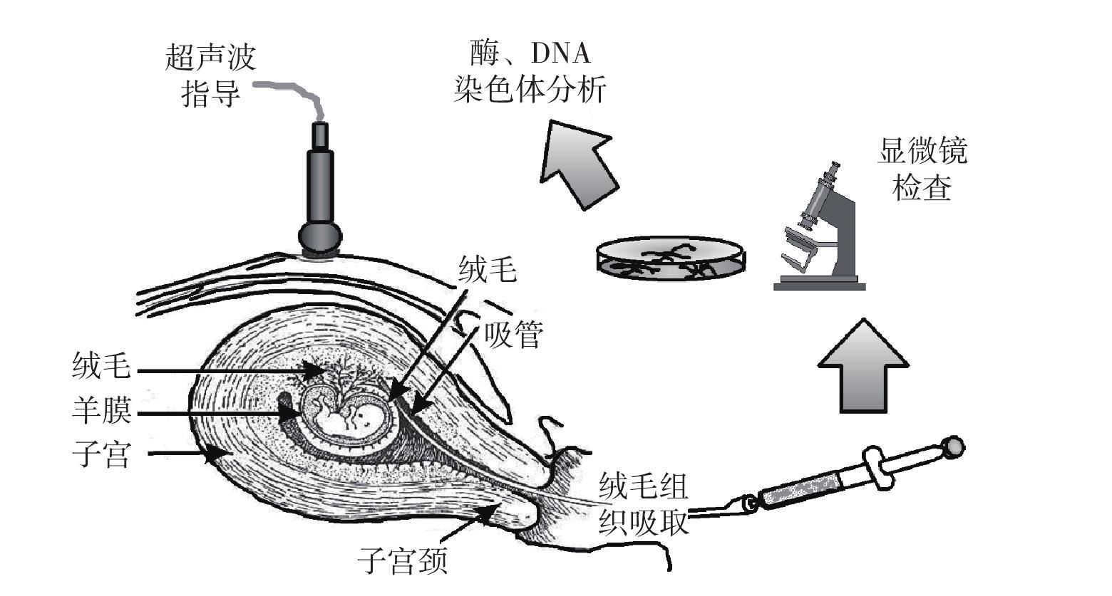 图17～17 脐带形成(一)-功能组织学与胚胎学-医学